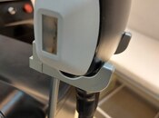 "Diod" lazer epilyasiya aparatı